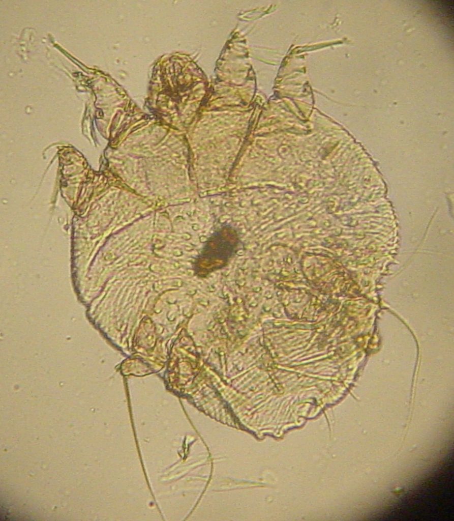 sarcoptes scabei 2 2