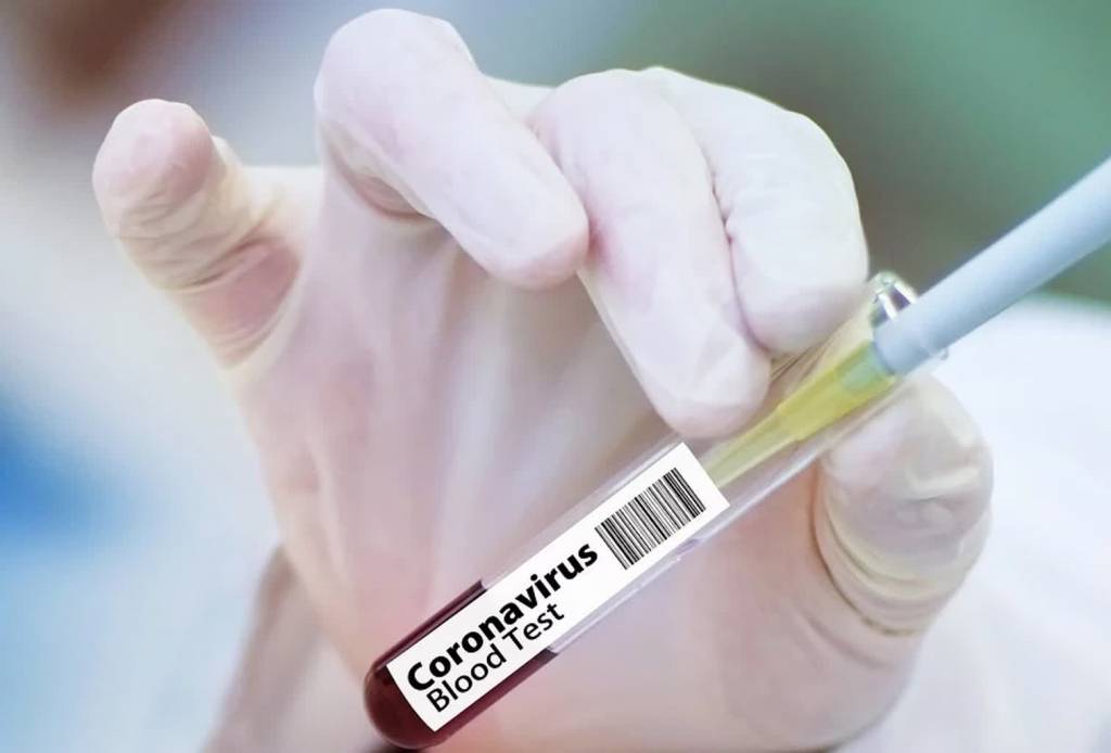 ozdrowienct 2020 04 09 182008 2020 04 12 170610