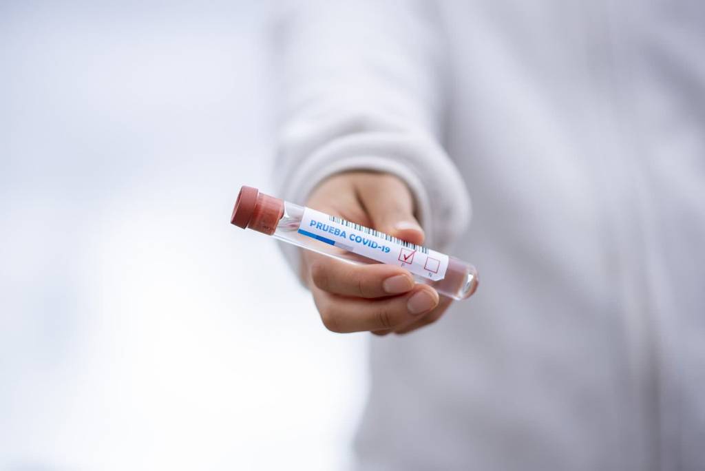 Nowe przypadki zakażenia koronawirusem w regionie. 7 osób z pozytywnymi wynikami 1 test tube 5065426 1920 2020 04 22 100713